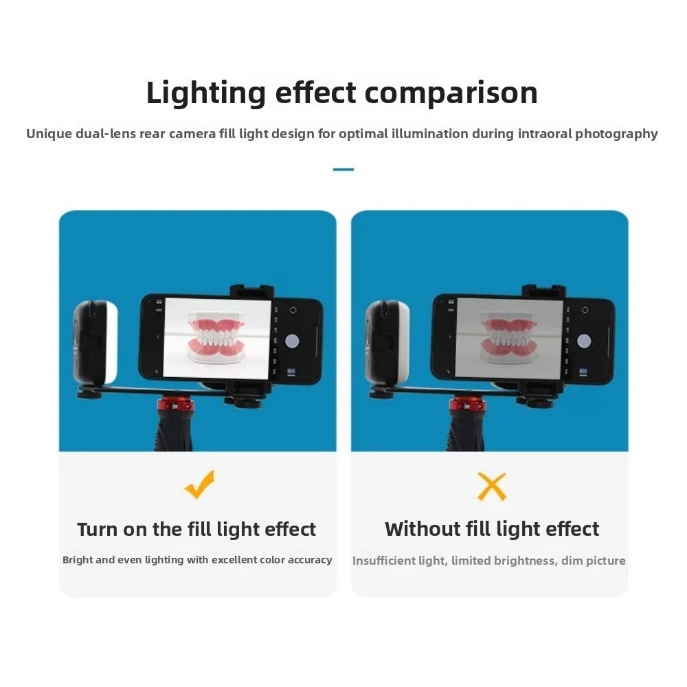 Dental Photography Light, Blue - Photography Lighting Portable ulasan dan harga